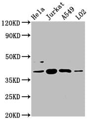 Polyclonal Rabbit anti-Human SHARPIN Antibody (IHC, IF, WB)