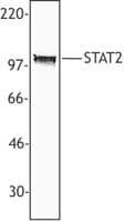 IHC-plus™ Polyclonal Rabbit anti-Human STAT2 Antibody (C-Terminus, IHC, WB)