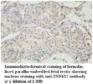 ZNF432 Antibody (aa243-502)