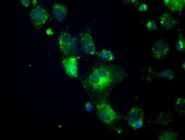 CRYAB / Alpha B Crystallin Antibody (clone OTI5C9)