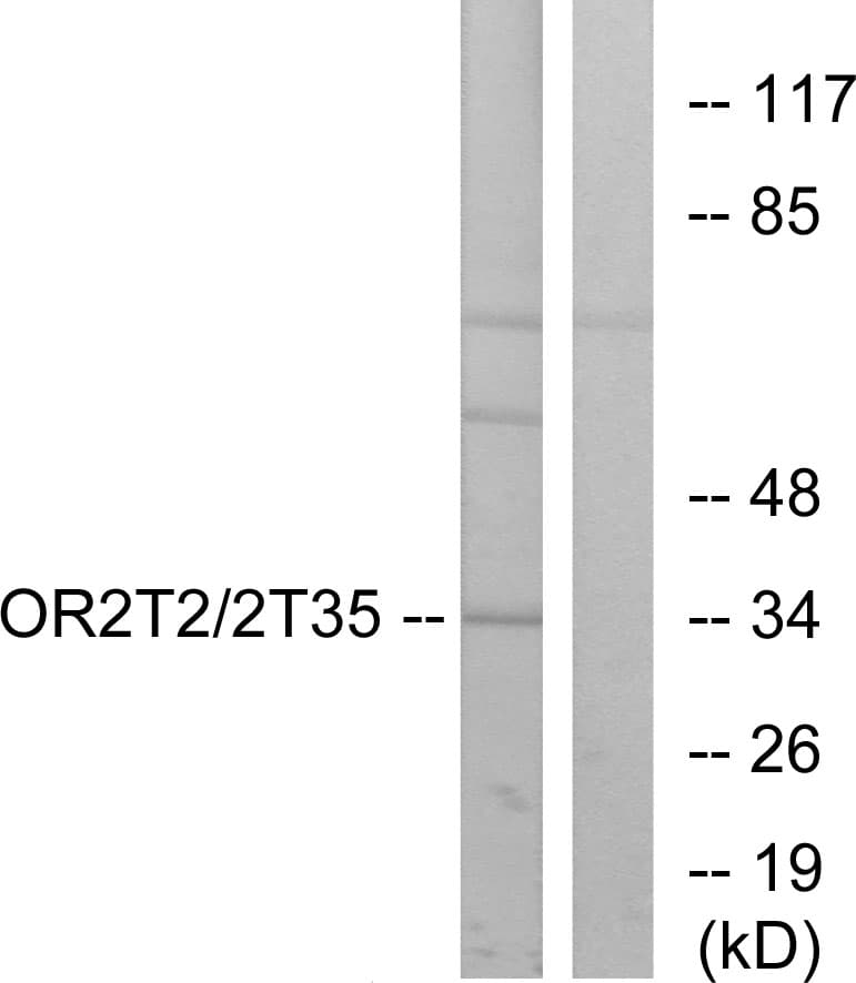 Polyclonal Rabbit anti-Human OR2T2 + OR2T35 Antibody (Internal, IF, WB)