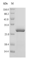 Duck LYZ / Lysozyme Protein (Recombinant 6His-SUMO, N-terminus)