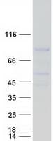 Human REC8 Protein (Recombinant Myc-DDK (Flag))