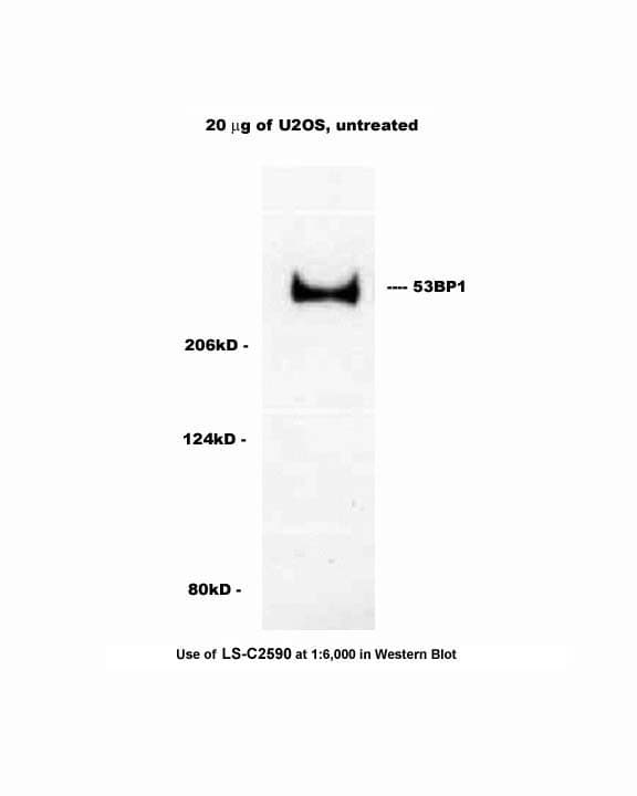TP53BP1 / 53BP1 Antibody (Biotin)
