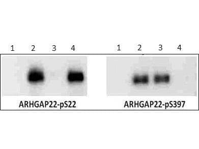 Polyclonal Rabbit anti-Mouse ARHGAP22 / RhoGAP2 Antibody (phospho-Ser397, IHC, IF, WB)