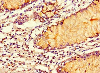 Polyclonal Rabbit anti-Human SMOC1 Antibody (IHC, IF, WB)
