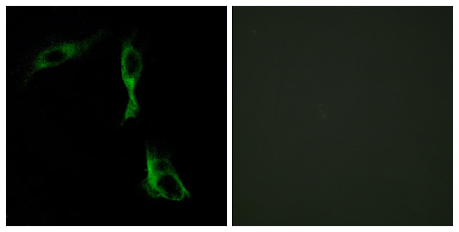 ADRA1D / Adrenoceptor alpha 1D Antibody (aa451-500)