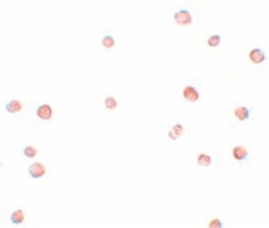 IHC-plus™ Polyclonal Rabbit anti-Human LRRC19 Antibody (IHC, IF, WB)