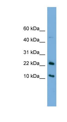 GM2A Antibody (aa35-84)