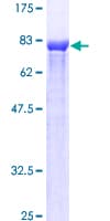 Human ETV6 / TEL Protein (Recombinant GST)