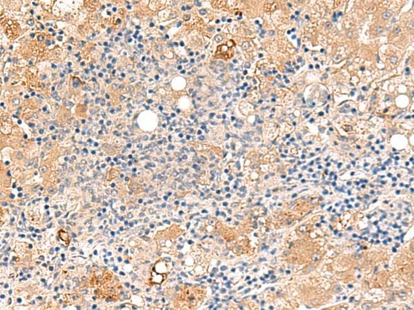 Polyclonal Rabbit anti-Human PEG1 / MEST Antibody (IHC, WB)