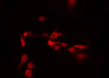C/EBP Delta / CEBPD Antibody