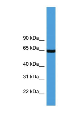 Polyclonal Rabbit anti-Human ASNS Antibody (aa358-407, WB)