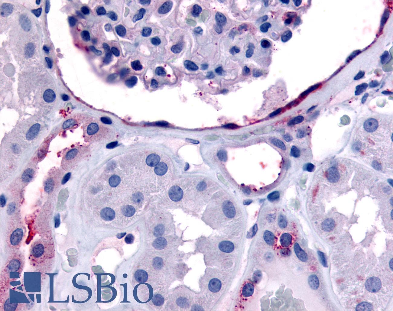 IHC-plus™ Polyclonal Rabbit anti-Human ERBB4 / HER4 Antibody (C-Terminus, IHC)