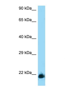 KLRD1 / CD94 Antibody (aa61-110)