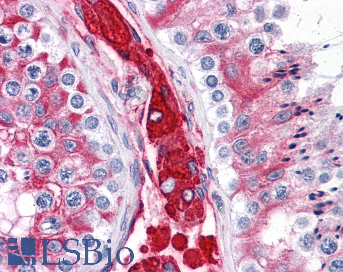 IHC-plus™ Polyclonal Rabbit anti-Human WDR35 Antibody (IHC)