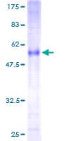 Human RNF144A / RNF144 Protein (Recombinant GST)