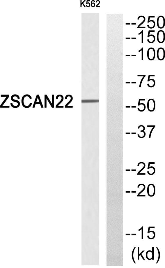 Polyclonal Rabbit anti-Human ZSCAN22 Antibody (IHC, WB)