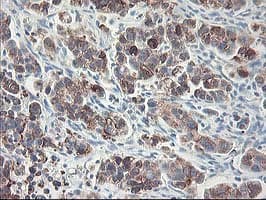 RPN1 / Ribophorin I Antibody (clone OTI2E3)