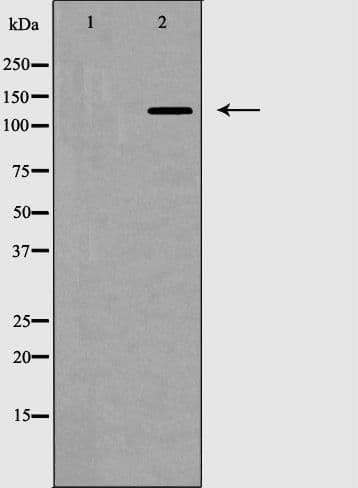 Polyclonal Rabbit anti-Human ZEB2 / SIP-1 Antibody (IHC, IF, WB)