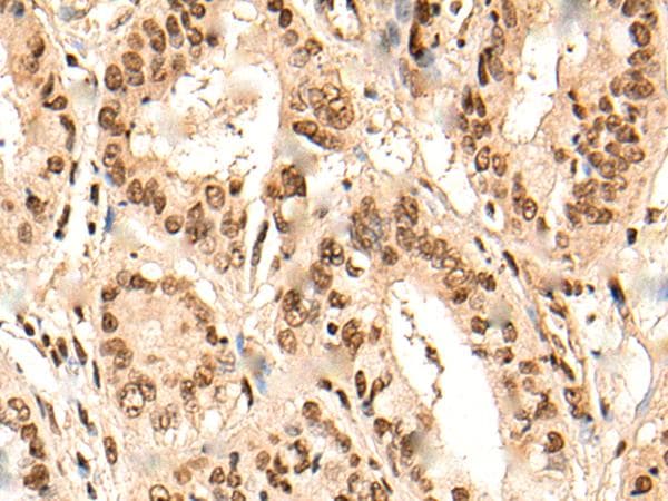 URI1 / NNX3 Antibody