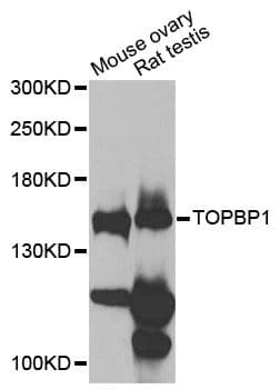 TOPBP1 Antibody