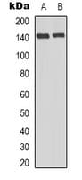 NOS3 / eNOS Antibody (phospho-Thr494)