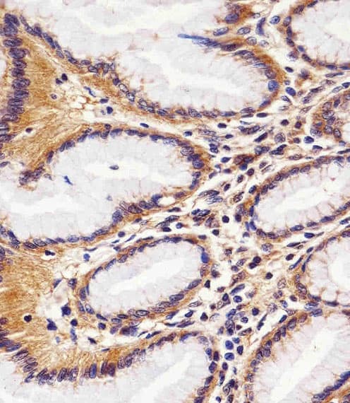 RAC1 Antibody (clone 1301CT276.121.104)
