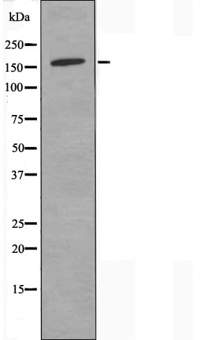 PNPLA6 / NTE Antibody