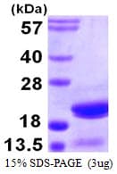 Human ARPC5 / p16-Arc Protein (Recombinant His)