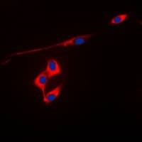 PRDX3 / Peroxiredoxin 3 Antibody (Internal)