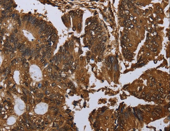 Polyclonal Rabbit anti-Human MYBBP1A Antibody (IHC)