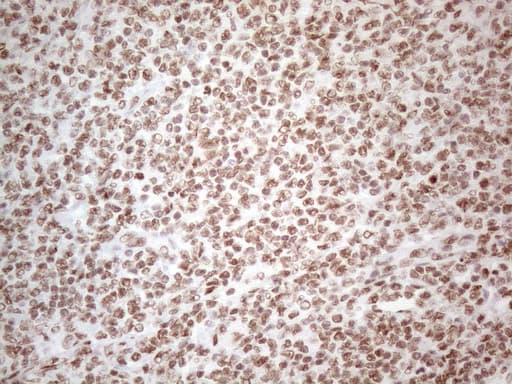 Monoclonal Mouse anti-Human HNRNPL / hnRNP L Antibody (clone OTI4E5, aa270-502, IHC)