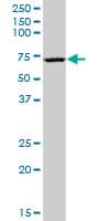 Monoclonal Mouse anti-Human EHD3 Antibody (clone 4B7, IHC, IF, WB)