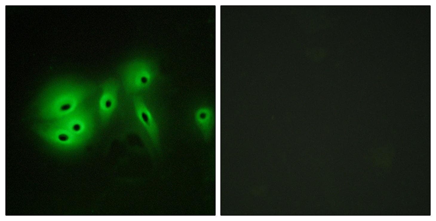 Polyclonal Rabbit anti-Human ADCY8 / Adenylate Cyclase 8 Antibody (IHC, IF)