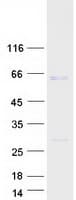 Human YBX3 / CSDA Protein (Recombinant Myc-DDK (Flag))