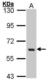 IHC-plus™ YES1 / c-Yes Antibody
