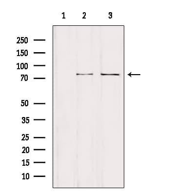 Polyclonal Rabbit anti-Human NCKIPSD / AF3P21 Antibody (WB)