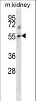 Polyclonal Rabbit anti-Mouse TGFBR1 / ALK5 Antibody (aa141-169, WB)
