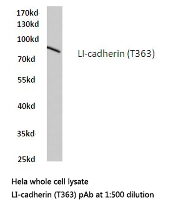 CDH17 / Cadherin 17 Antibody (Thr363)