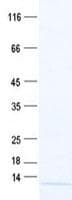 Human C5orf13 Protein (Recombinant His, N-Terminal)
