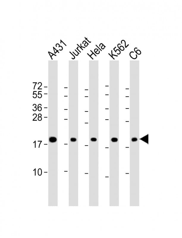 RPS10 / Ribosomal Protein S10 Antibody (Internal)