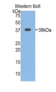 CSTA / Cystatin A Antibody (aa1-97)