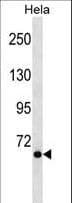 Polyclonal Rabbit anti-Human ARA70 / NCOA4 Antibody (aa496-524, WB)