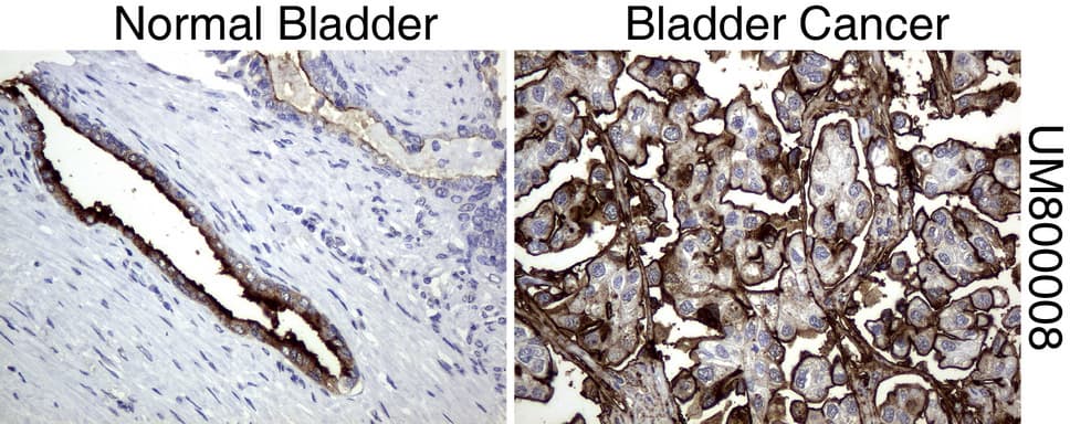EMA / MUC1 Antibody (clone UMAB57)