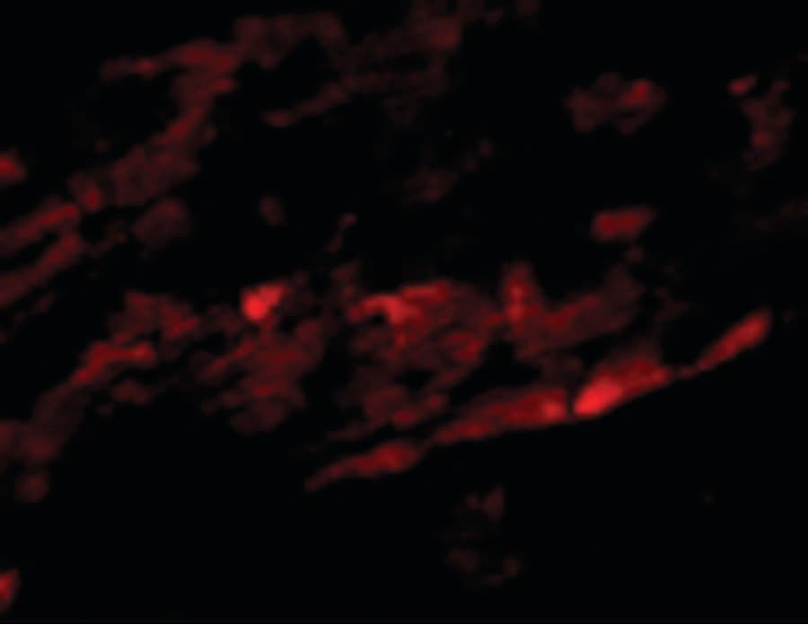 IHC-plus™ SPG15 / ZFYVE26 Antibody
