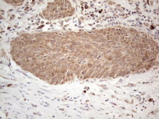 Monoclonal Mouse anti-Human PD-L2 / PDCD1LG2 / CD273 Antibody (clone OTI5E5, IHC, WB)