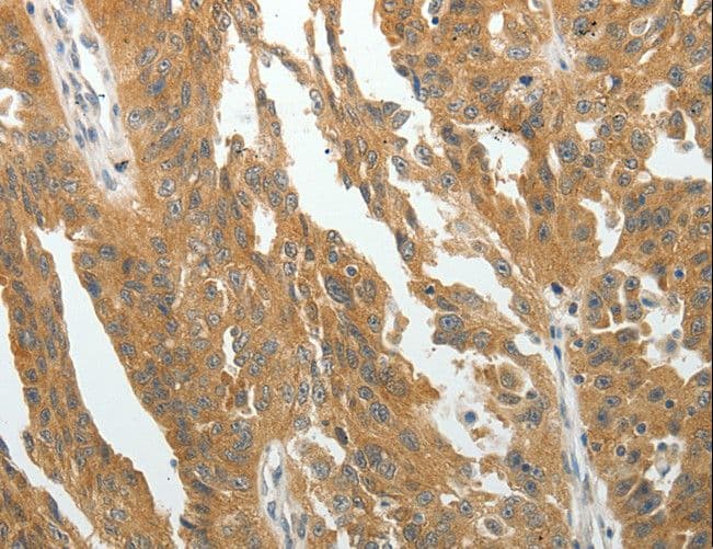 Polyclonal Rabbit anti-Human RARA / RAR Alpha Antibody (IHC)