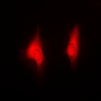 PSMB5 Antibody