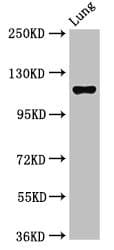 Polyclonal Rabbit anti-Human MAP3K9 / MLK1 Antibody (IHC, WB)